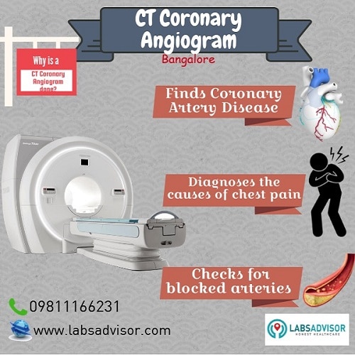 Procedure of CT Coronary Angiogram scan in Bangalore!