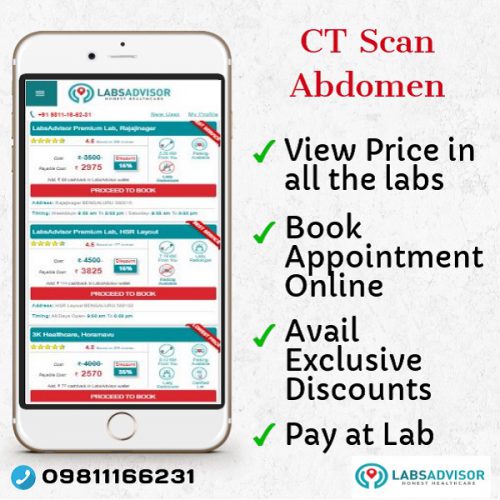 View CT Scan Abdomen Cost in Bangalore in all the labs and book appointment at discounted price on LabsAdvisor.com.