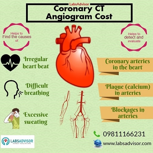 Reasons for taking a Coronary CT Angiogram - Mumbai