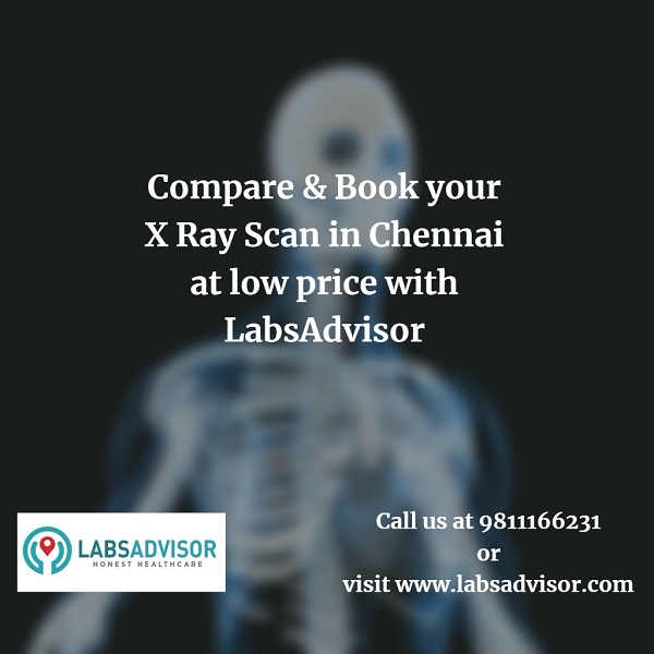 Know more about X Ray Scan Cost in Chennai by calling LabsAdvisor at 9811166231