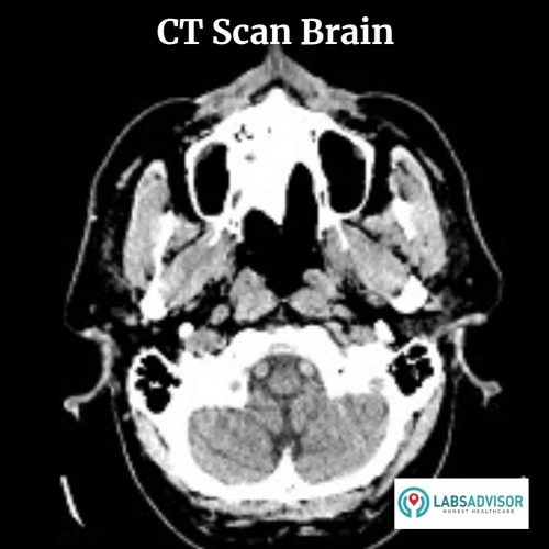 The image of a CT Scan Brain - India!