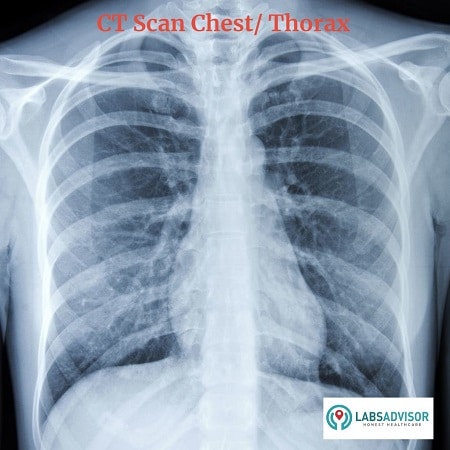 CT Scan Chest in India