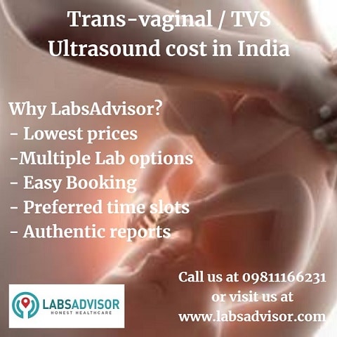 View TVS Test Cost in different labs on LabsAdvisor.