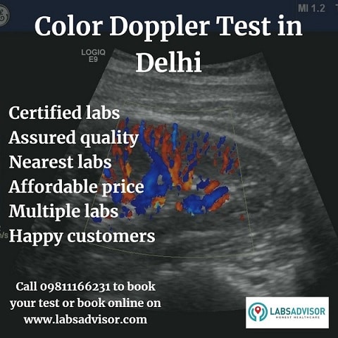 Colour Doppler Test Cost in Delhi!