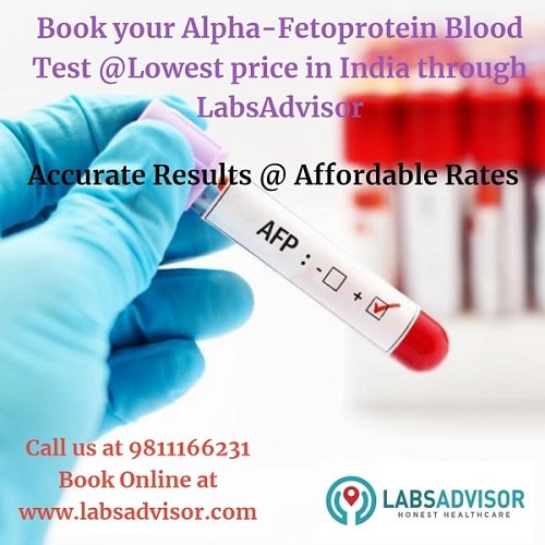 Medical conditions diagnosed using Alpha Feoprotein Test.