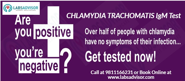 Chlamydia Test Offer.