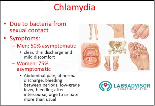 Symptoms of the chlamydia infection in men and women.
