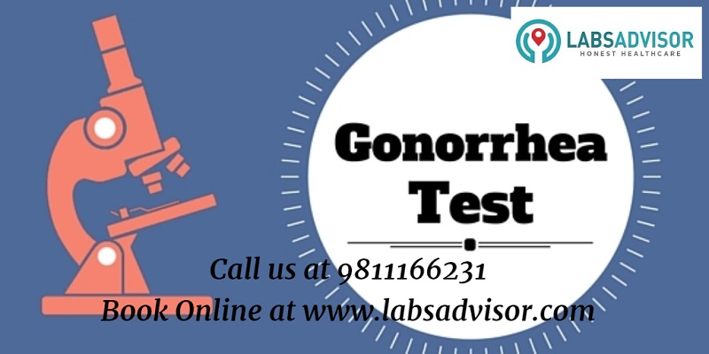 Symptoms of Gonorrhea in Men Explained.
