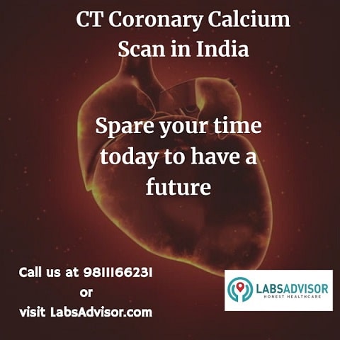 CT Coronary Calcium scan price in India!