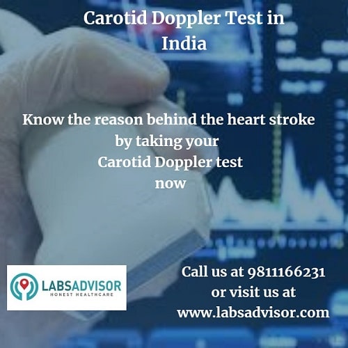 Carotid Doppler Test Procedure.