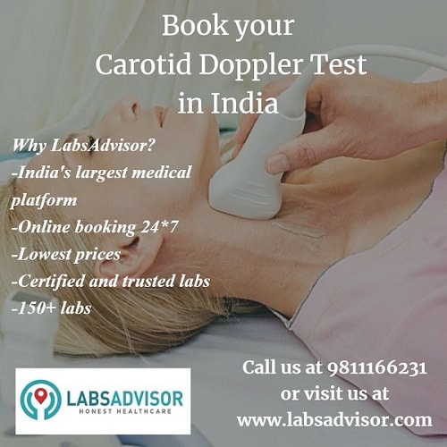 Know more about the benefits of booking the Carotid Doppler Test with LabsAdvisor.