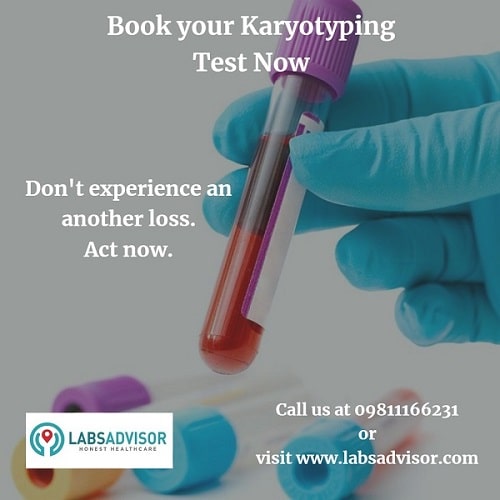 Know more about Karyotype Test Cost in India with LabsAdvisor by calling us at 9811166321.