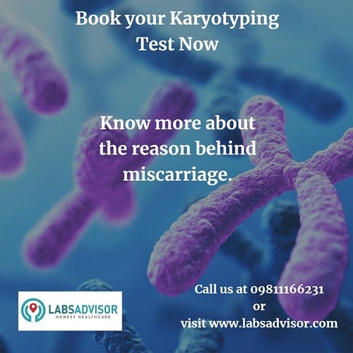 Book your lowest Karyotype Test Cost to detect chromosomal abnormalities in your body which may lead to miscarriage.
