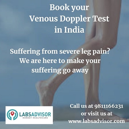 Venous Doppler Test Legs Cost in India Through Labsadvisor!