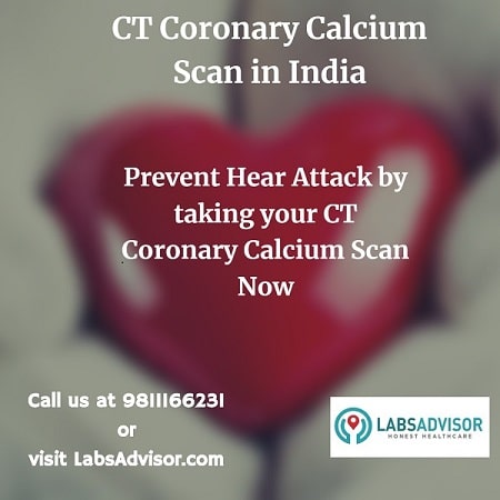 Heart Scan Cost in India through Labsadvisor!