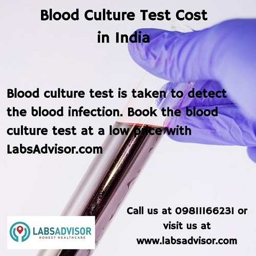 Get your Blood culture test done sitting at home to detect your blood infections.