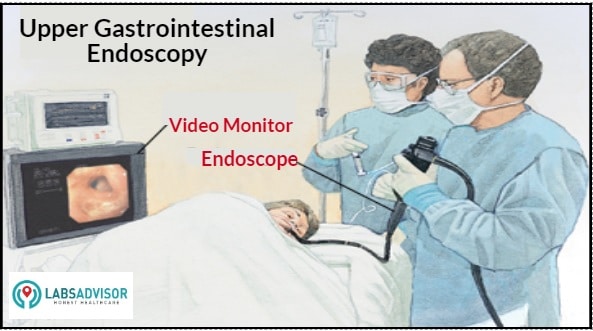 Endoscopy Procedure.