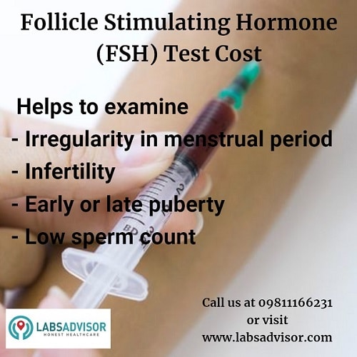 FSH Test helps to examine the various reproductive disorders. Get discounts on FSH Test Cost in best labs.