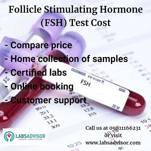 Get lowest FSH Test Cost in India - certified labs, free home collection