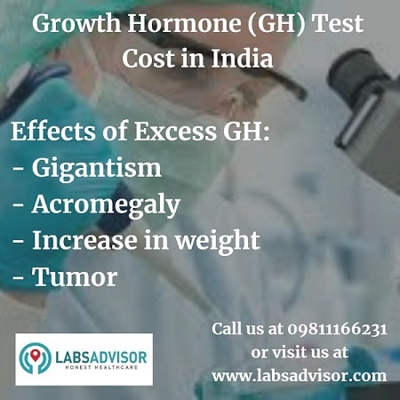 Effects of Excess growth hormone!