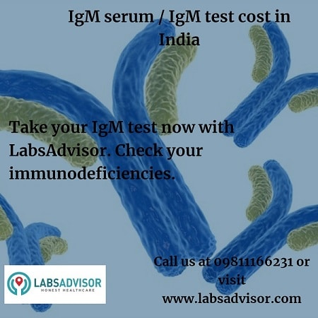 IgM test helps to check your autoimmune disorders.