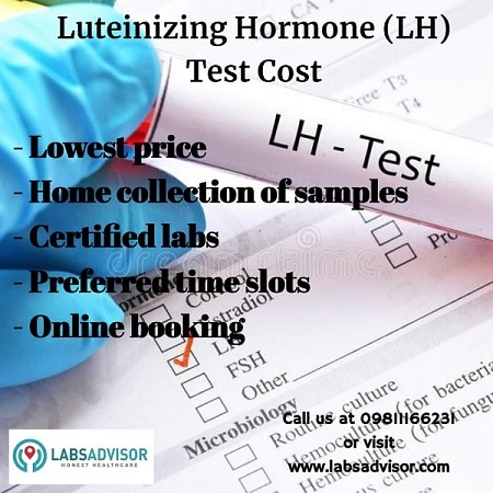Lowest LH Test Price in India Through Labsadvisor!