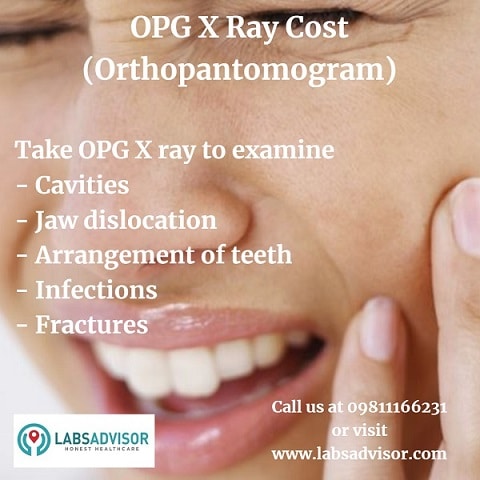 OPG X Ray Price in India!