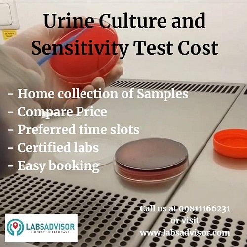 Avail 50% Off on Urine Culture Test Cost in certified labs. Take your test at home without visiting the labs.