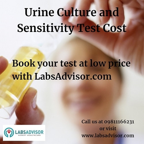 Get lowest Urine Culture Test Cost in certified labs all across India with the option of home collection of samples.