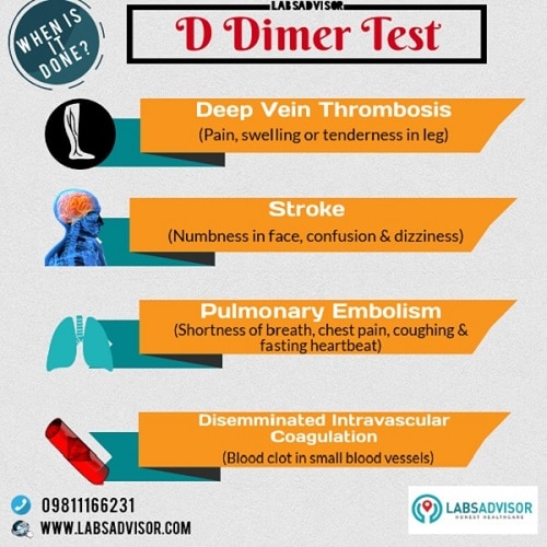 Uses of D Dimer Test - India.