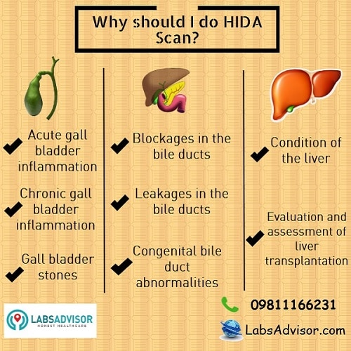 HIDA Scan diagnoses the condition of gall bladder, bile ducts and liver.