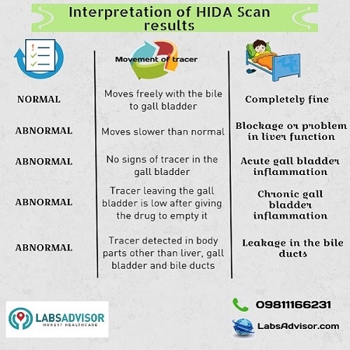 Interpretation of Hepatobiliary Scan / HIDA Scan results