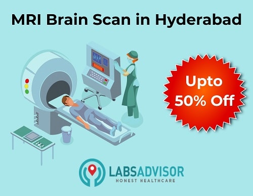 Lowest MRI Brain Cost in Hyderabad!