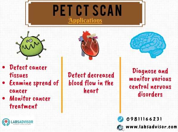 Medical conditions diagnosed using PET Scan.