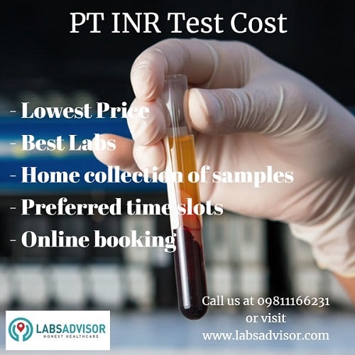 Find best labs with the lowest PT INR Test cost and book your test at home with preferred time slots online.