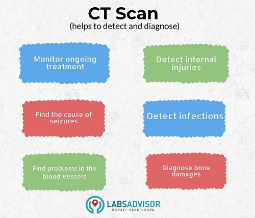 CT Scan in Pune - Uses