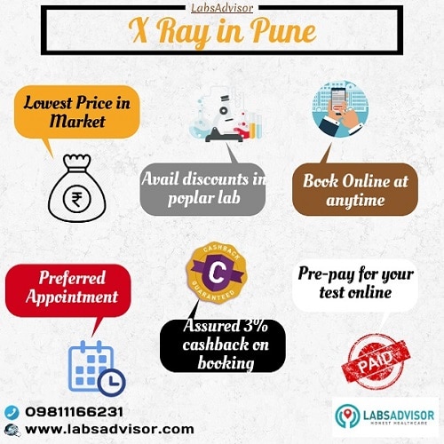 Lowest X Ray Cost in Pune in all the best labs.