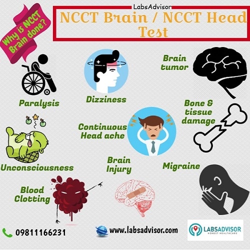 Reasons for taking an NCCT Brain scan - India! 