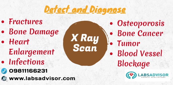 X ray scan is done to detect and diagnose various medical conditions such as fractures, damage, bone cancer, osteoporosis, etc - Hyderabad