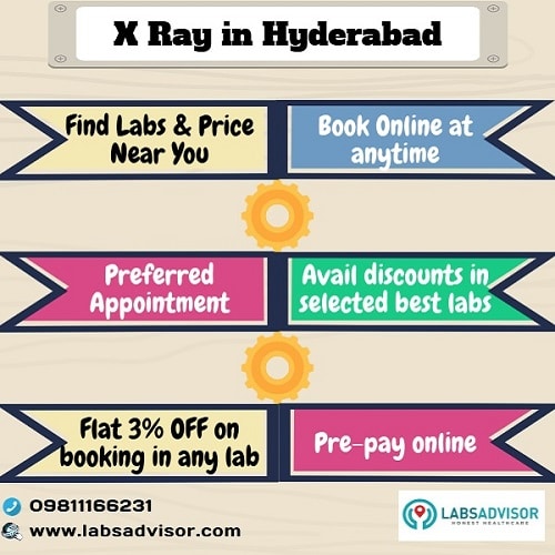 Lowest X Ray Cost in Hyderabad in all the best labs.