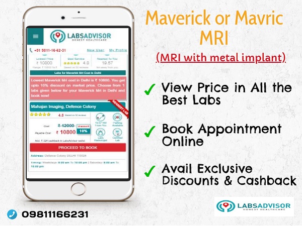 Lowest Mavric MRI price through LabsAdvisor.