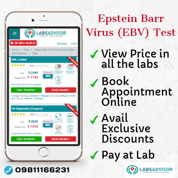 Minimum Price of Epstein Barr Virus IgG Test in Delhi, Gurgaon, Mumbai, Bangalore, Chennai, etc.