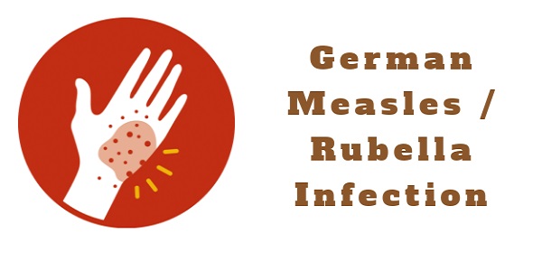 German Measles or Rubella Infection.