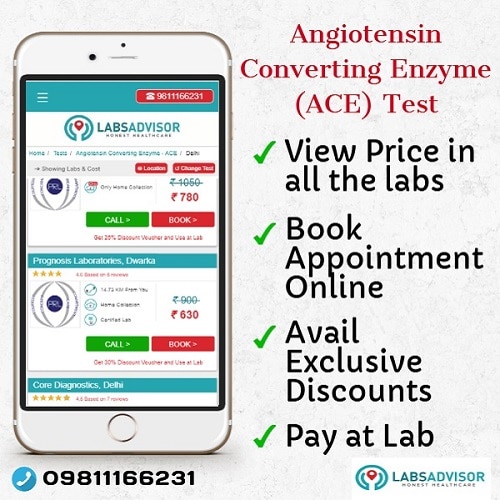 Lowest ACE Blood Test Cost in Delhi, Gurgaon, Bangalore, Mumbai, Chennai, Hyderabad, etc.