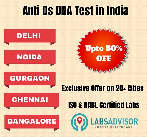 Anti Ds DNA test cost in various cities of India