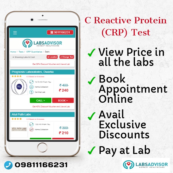 Lowest C Reactive Protein (CRP) Test Cost in Delhi, Gurgaon, Mumbai, Bangalore, Hyderabad, Chennai, etc.