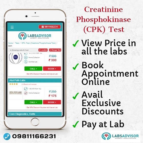 Lowest Creatinine Phosphokinase (CPK) Test Cost in Delhi, Gurgaon, Bangalore, Mumbai, and other cities.