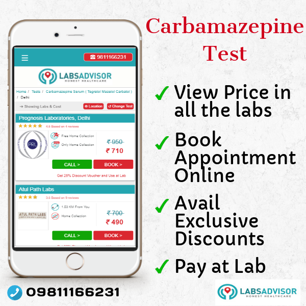 when do you check carbamazepine levels
