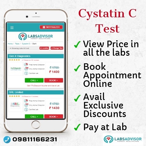 Lowest Cystatin C Test Cost in Delhi, Gurgaon, Bangalore, Mumbai, Chennai, Hyderabad, etc.