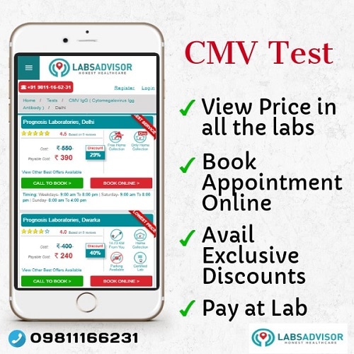Lowest CMV Test Price through LabsAdvisor.